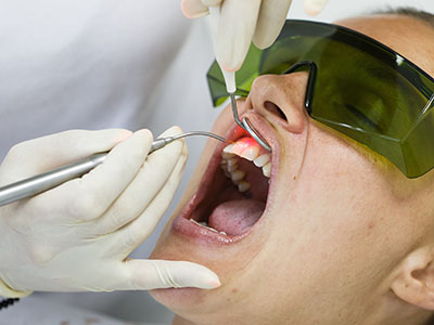 Beyond Care Therapy | Dental Cleanings, Full Mouth Reconstruction and Air Abrasion